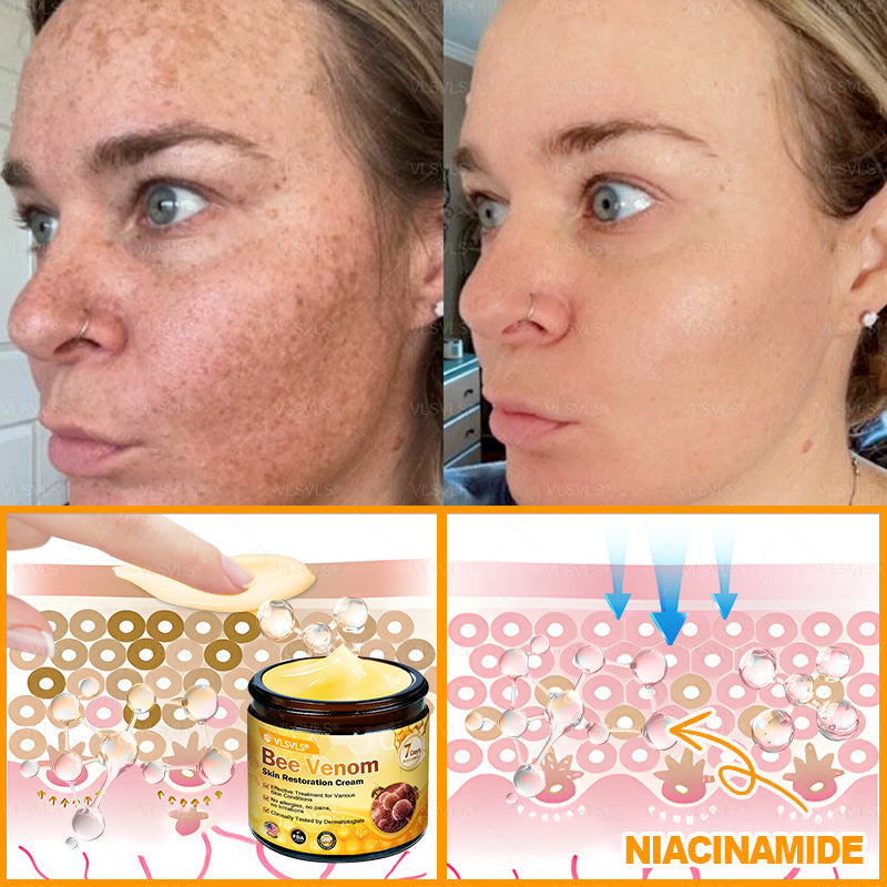 Made and Shipped from USA ✨ VLSVLS® Bee Venom Skin Restoration Cream 🔥 LAST DAY 80% OFF 💎
