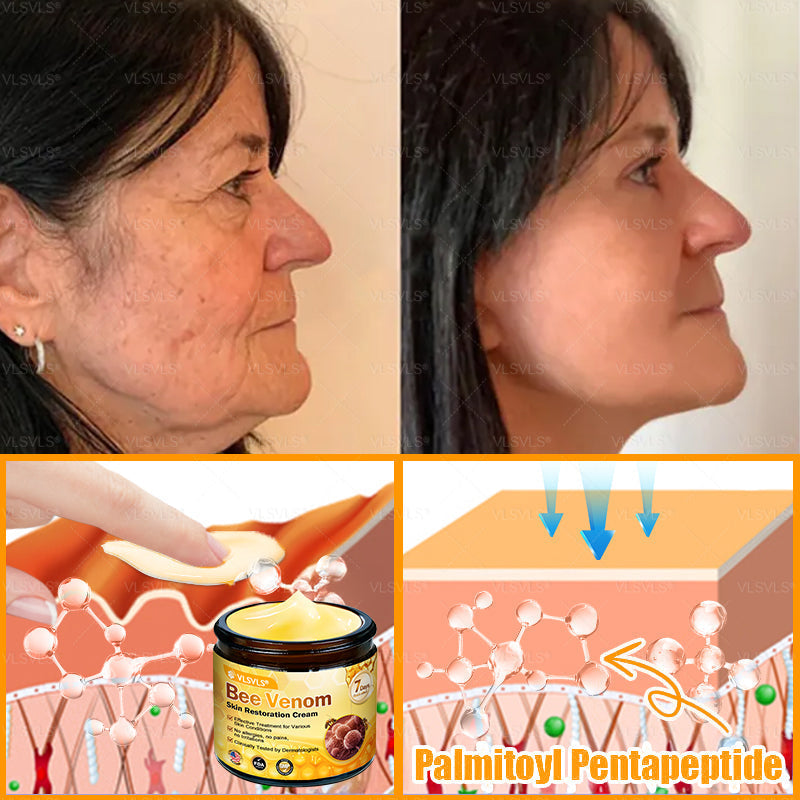 Made and Shipped from USA ✨ VLSVLS® Bee Venom Skin Restoration Cream 🔥 LAST DAY 80% OFF 💎