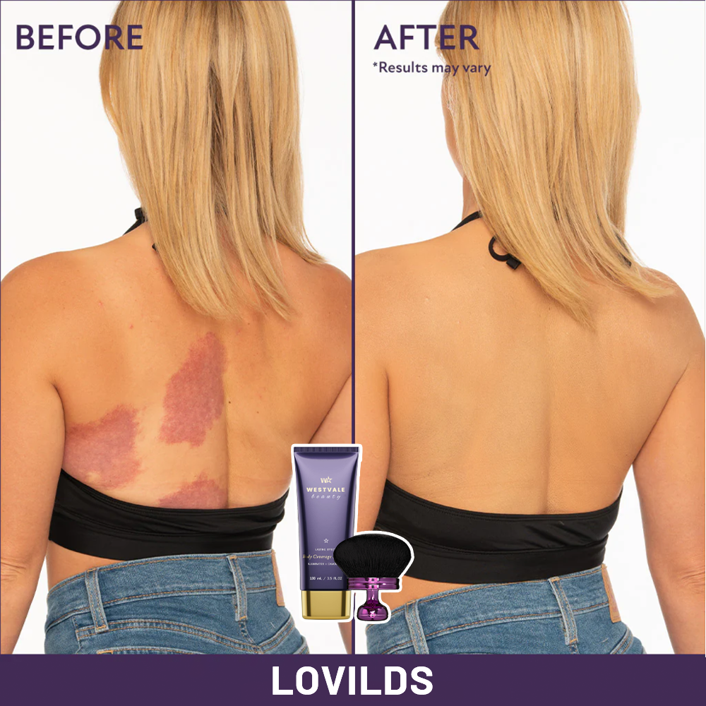 ✨Final 3 Hours  70% OFF 1:Beauty Body Coverage Perfector with Brush