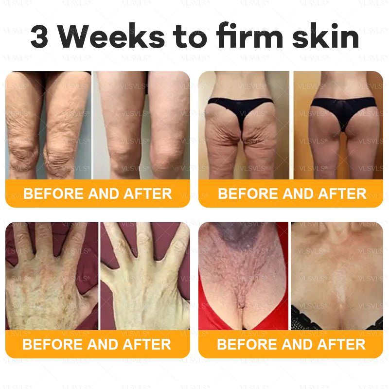Made and Shipped from USA ✨ VLSVLS® Bee Venom Skin Restoration Cream 🔥 LAST DAY 80% OFF 💎