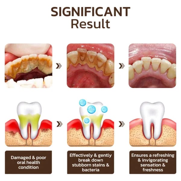 🦷Final 3 Hours: 60% OFF Nicotinamide Whitening Toothpaste🔥