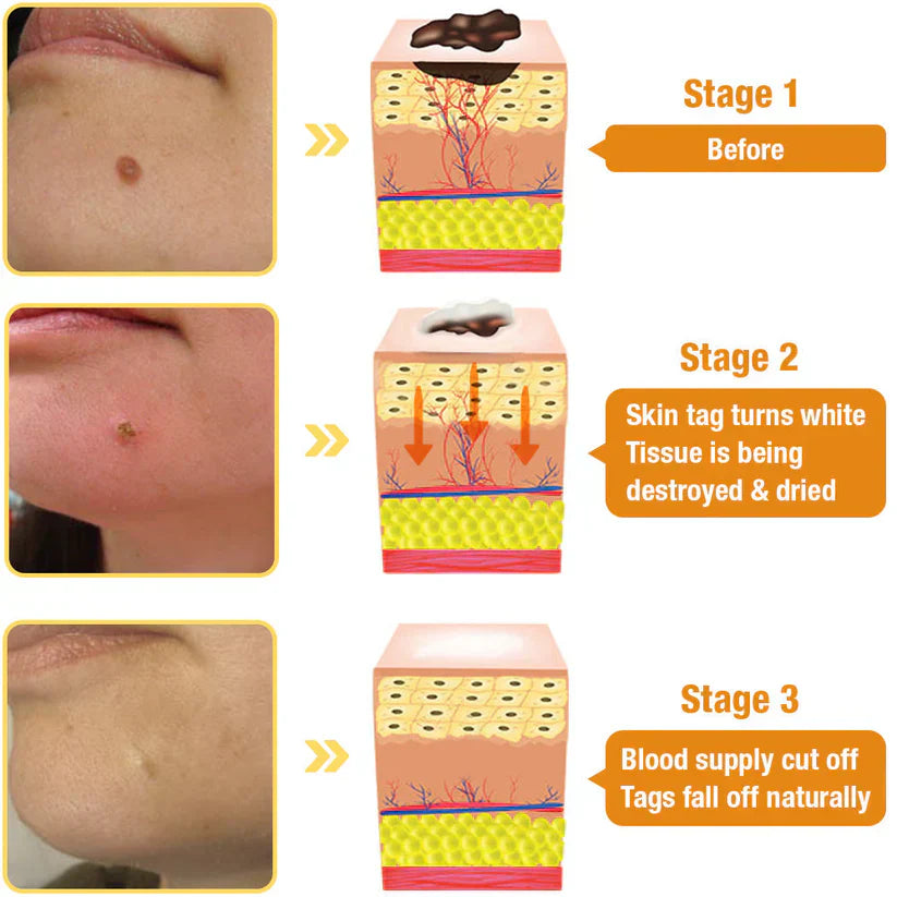 ✨𝐋𝐚𝐬𝐭 𝐃𝐚𝐲 𝐃𝐢𝐬𝐜𝐨𝐮𝐧𝐭: 87% 𝐎𝐅𝐅 🐝AQA™ TagRecede Bees Treatment Spray