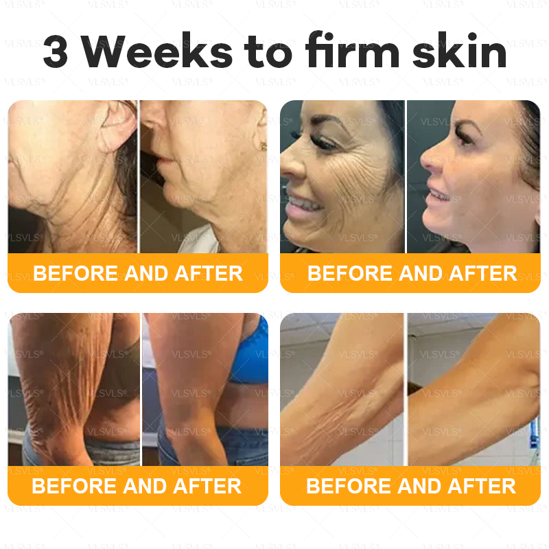 Made and Shipped from USA ✨ VLSVLS® Bee Venom Skin Restoration Cream 🔥 LAST DAY 80% OFF 💎