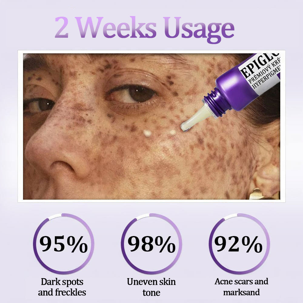 💜Vaxflite™ Retinol Radiance Cream | Dermatologist-Backed Brightening Formula