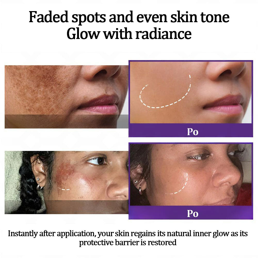 💜Vaxflite™ Retinol Radiance Cream | Dermatologist-Backed Brightening Formula
